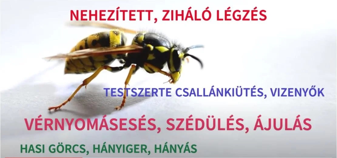 anafilaxia csípés allergia