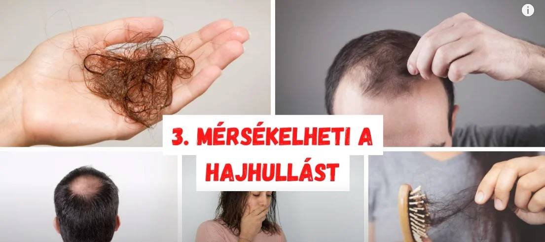 haj hajhullás gyógymód hajápolás kopasz