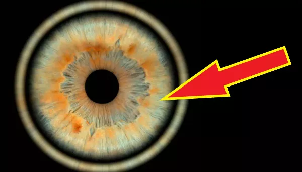 Mit mutat meg az írisz diagnosztika 👁 az egészségedről?  A szem valóban a test és a lélek tükre?