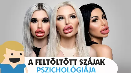 Feltöltött száj – szépségtrend vagy a testképzavar új jele?